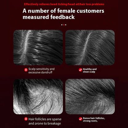 ScalpEase™ Pro – Electric Head Massager & Hair Oil Applicator